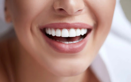 Cách chăm sóc và bảo quản răng sứ veneer hiệu quả