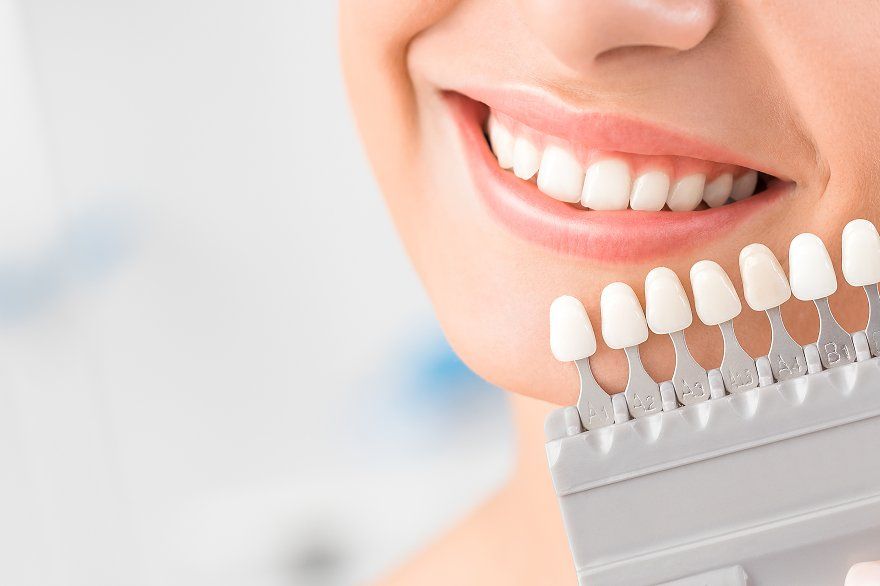 Bọc Răng Sứ Thẩm Mỹ – Giải Pháp Phục Hình Nụ Cười  (1)