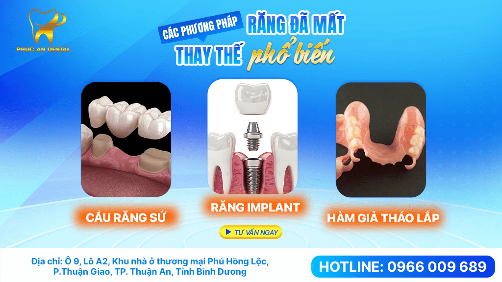 Các Phương Pháp Phục Hình Răng Mất Phổ Biến Hiện Nay (1)