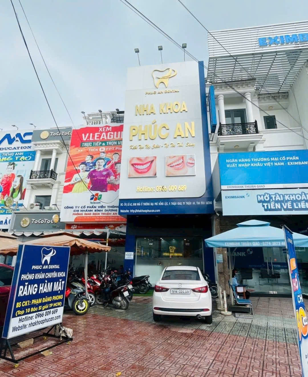 Các Phương Pháp Phục Hình Răng Mất Phổ Biến Hiện Nay