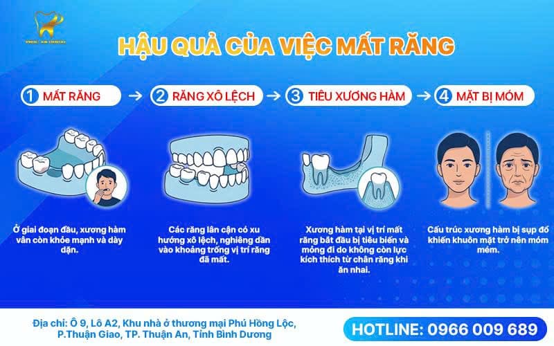 Tại Sao Mất Răng Lại Ảnh Hưởng Nghiêm Trọng Đến Chức Năng Ăn Nhai