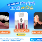 Nụ cười tự nhiên sau khi bọc răng sứ chính hãng