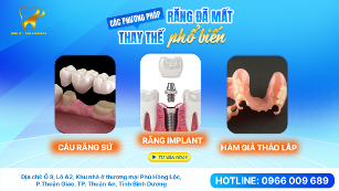 Nụ cười tự nhiên sau khi bọc răng sứ chính hãng